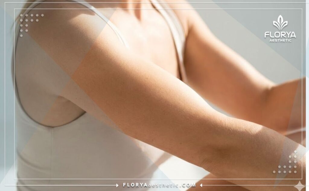 Идеальный результат подтянутых и красивых рук после эстетической процедуры.