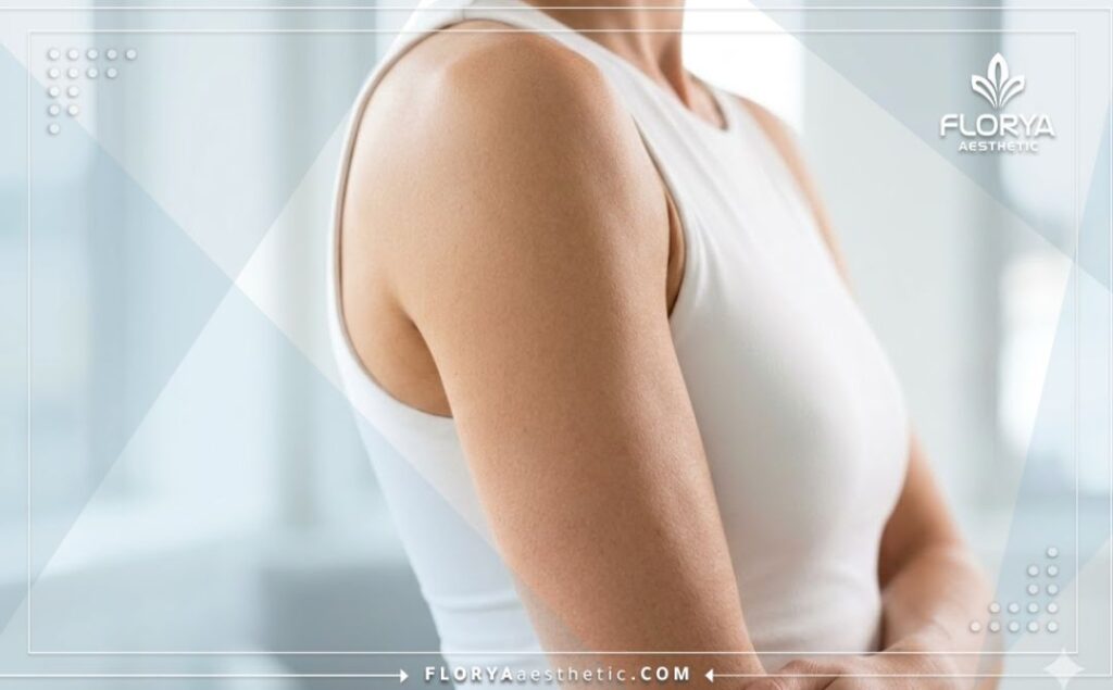 نتائج مثالية وذراعين مشدودتين بعد العملية