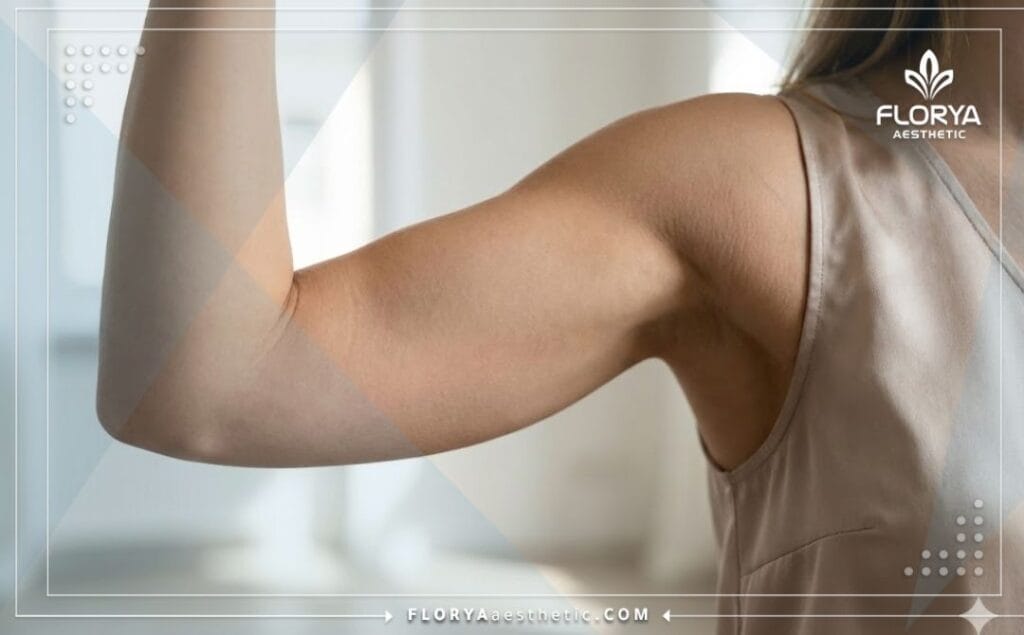 Идеальный результат подтяжки рук с гладкой кожей