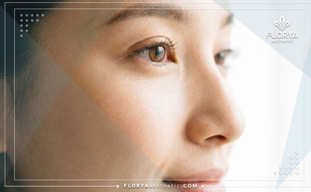 Close-up of a perfect almond eye shape result after surgery