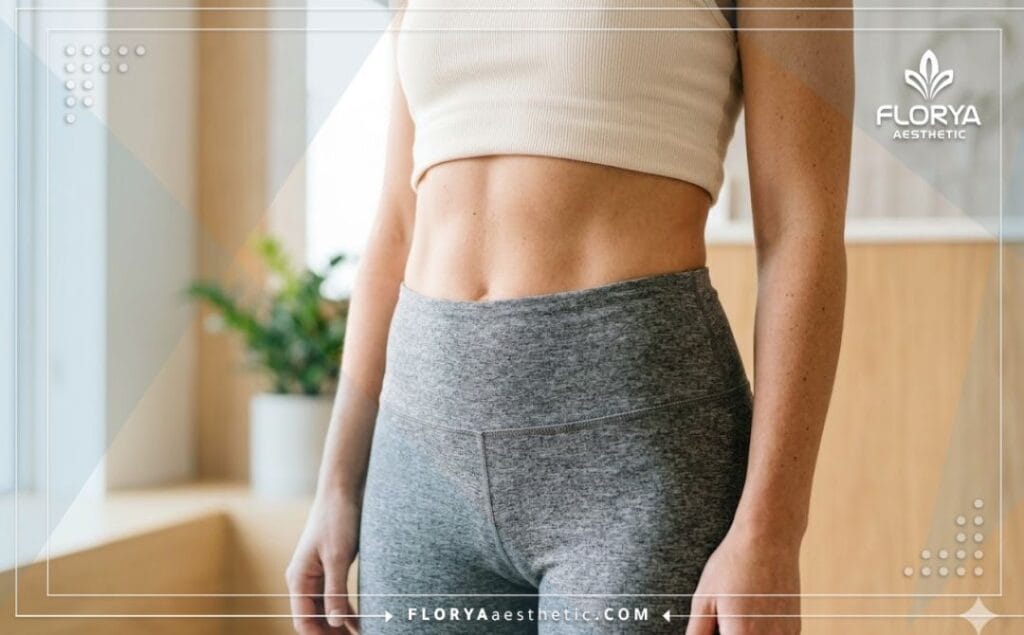 Perfect, aesthetic result showing a fit and healthy waistline after treatment.