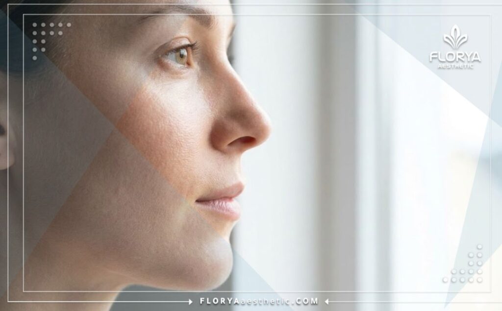 نتيجة مثالية وطبيعية لعملية تجميل الأنف تبرز جمال الوجه وتناسقه.