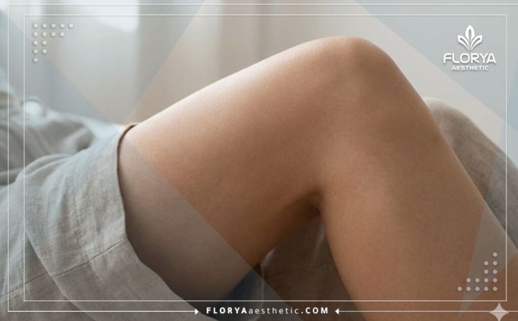 Perfect and smooth thigh lift result with natural aesthetic contours