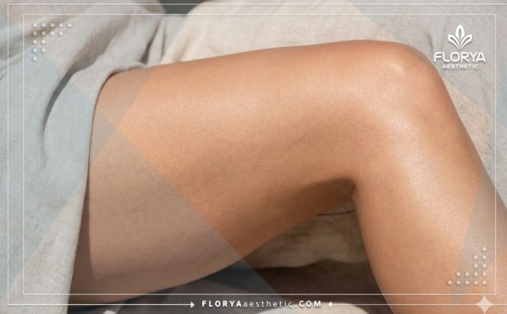 Close-up cinematic shot showing perfectly sculpted thighs after successful liposuction.