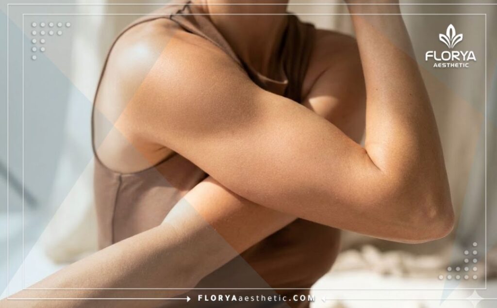 Resultado perfecto, natural y tonificado después de la cirugía de contorno de brazos