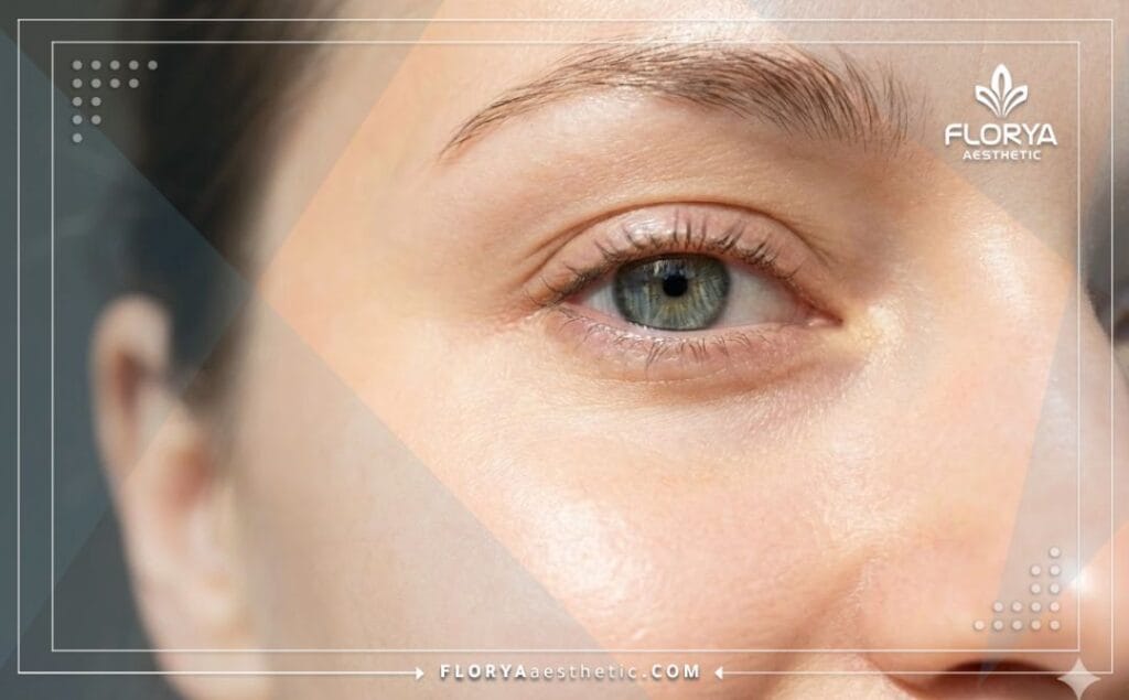 Primer plano de un ojo hidratado y saludable como resultado perfecto