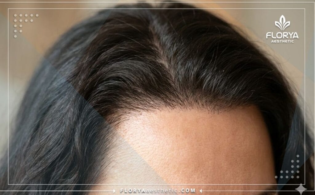 Идеальный результат густых волос после процедуры восстановления