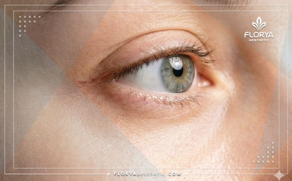 صورة مقربة توضح العين بصحة ممتازة ونتيجة مثالية للعلاج