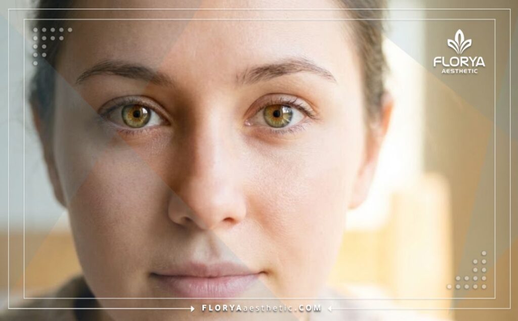 Primer plano cinematográfico de ojos claros tras la operación de hipermetropía.