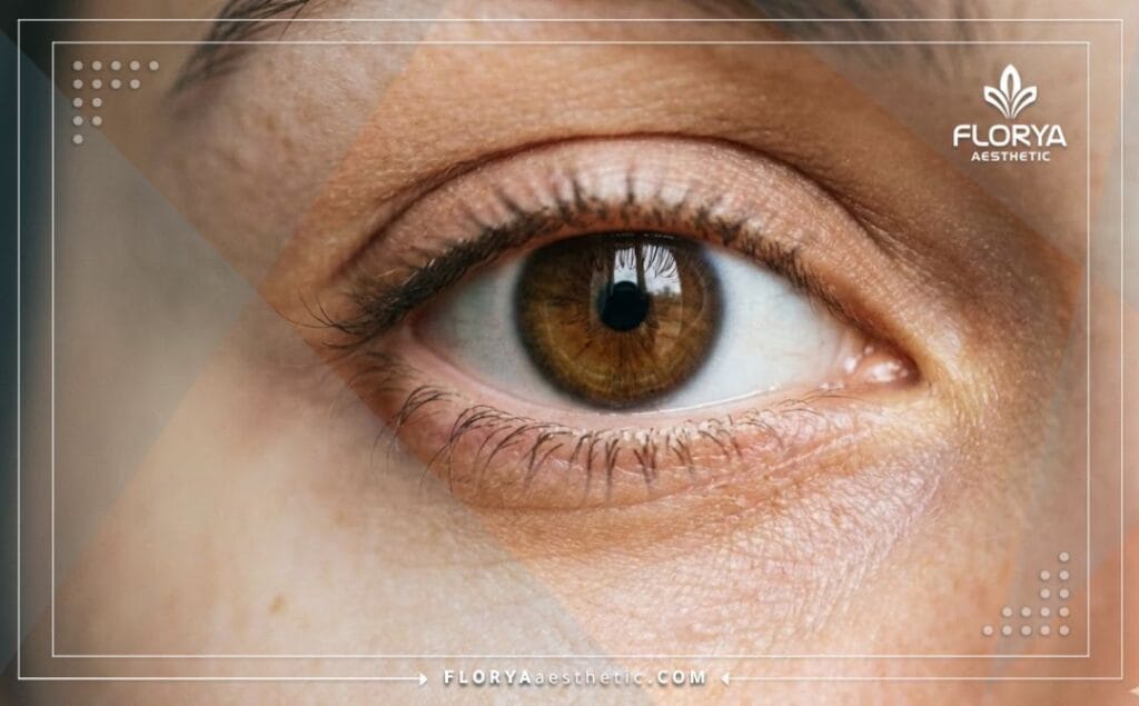 Close-up of a clear bright eye showing perfect vision results