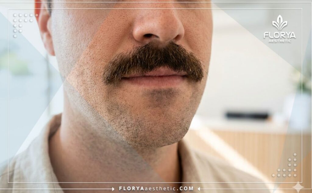 Gros plan sur le résultat parfait et la densité naturelle de la moustache