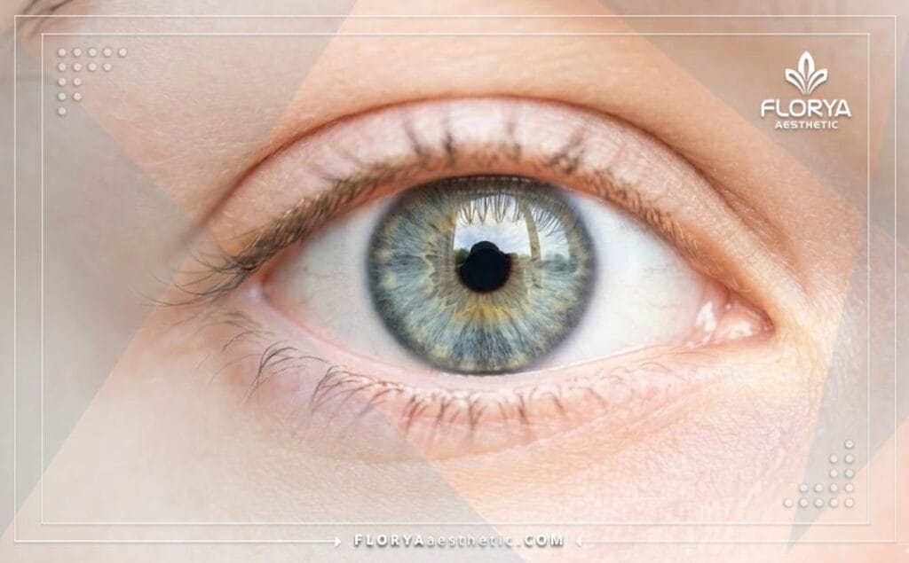 Крупный план здорового глаза после успешного лечения