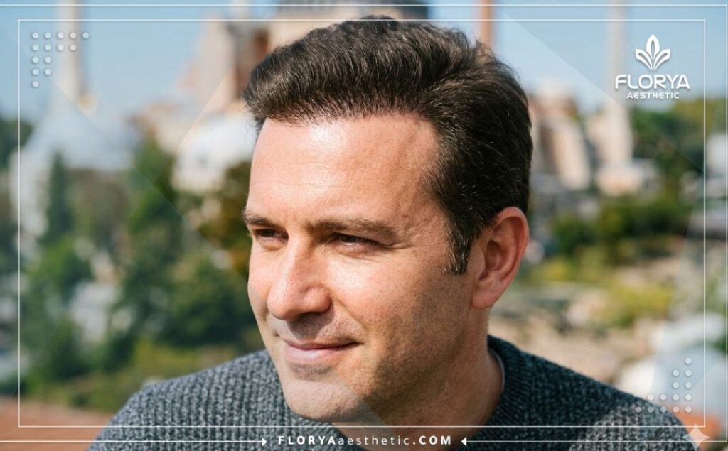 Идеальный и естественный результат восстановления густоты волос