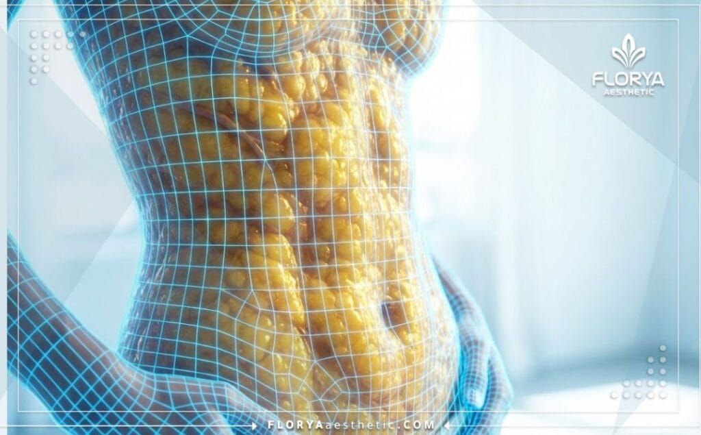 Visualisation 3D des tissus adipeux pour la planification de la liposuccion laser