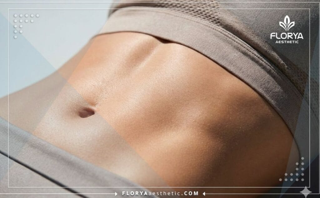 Close-up of a perfectly sculpted and toned abdomen showing the result of SmartLipo.