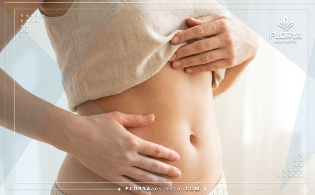 Идеальный результат плоского живота после абдоминопластики