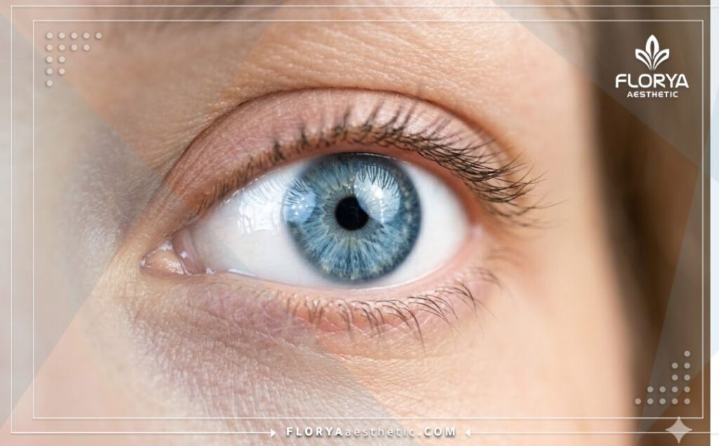 Идеально прозрачный глаз, демонстрирующий успешный результат имплантации.