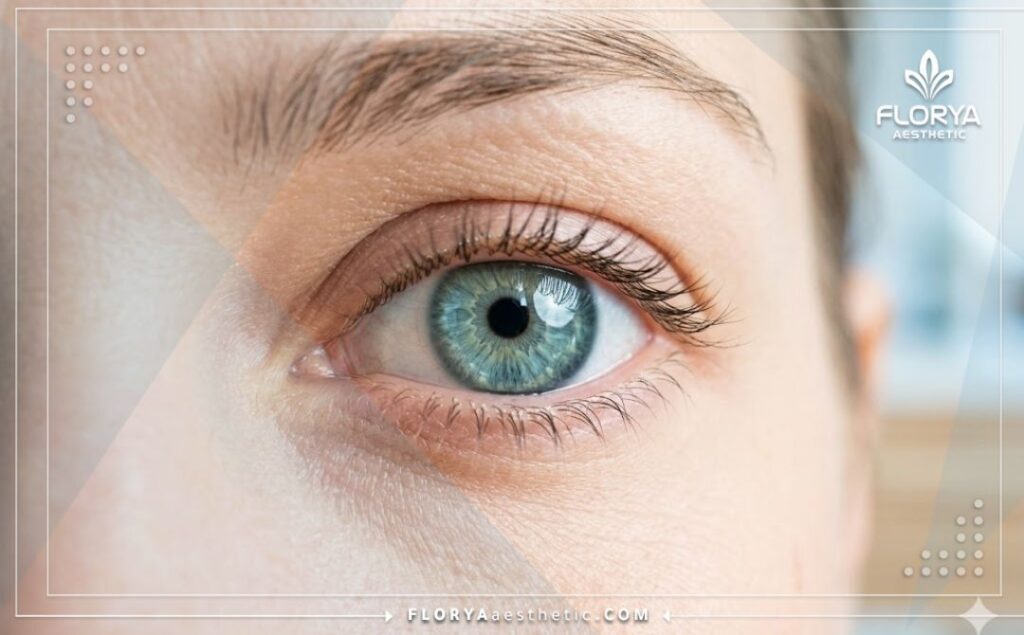 Close-up of a vibrant, healthy eye after successful American IOL implantation.