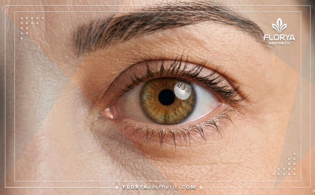 نتيجة مثالية ورؤية واضحة بعد عملية الليزك