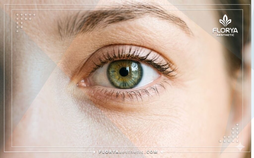 Идеальный результат после успешной лазерной операции на глазах