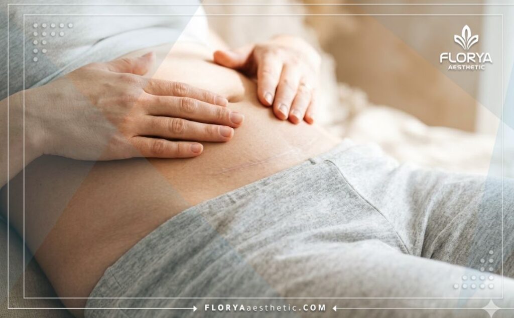 Résultat esthétique parfait montrant une peau lisse et réparée après la procédure.