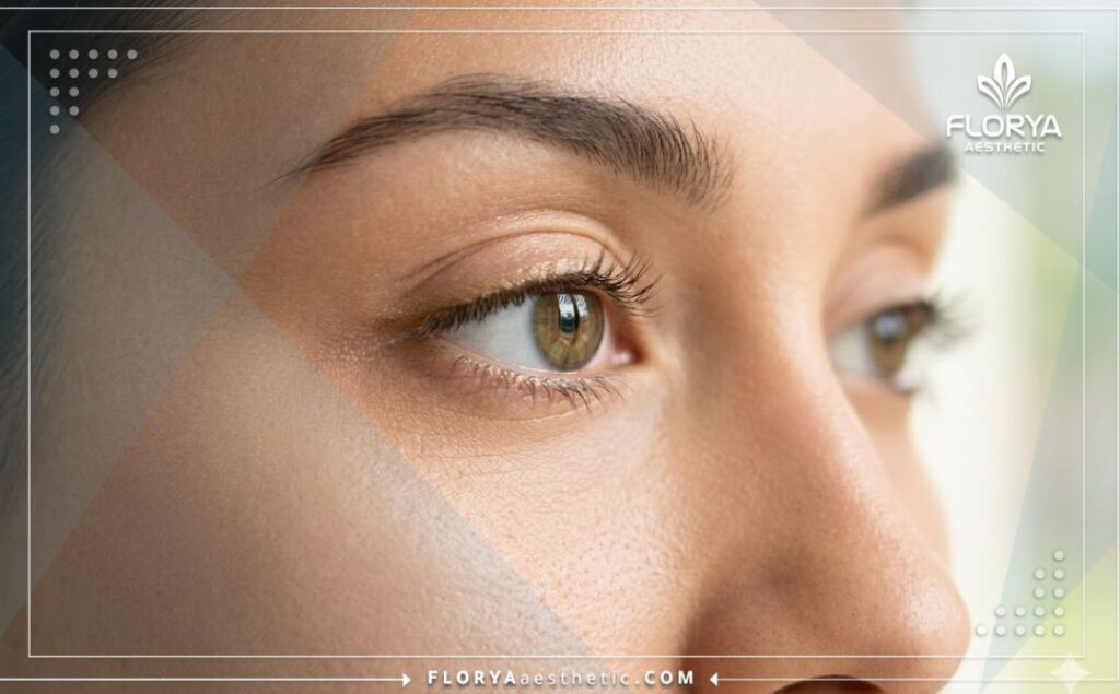 Идеальный результат здорового и красивого глаза после успешной процедуры на веке.