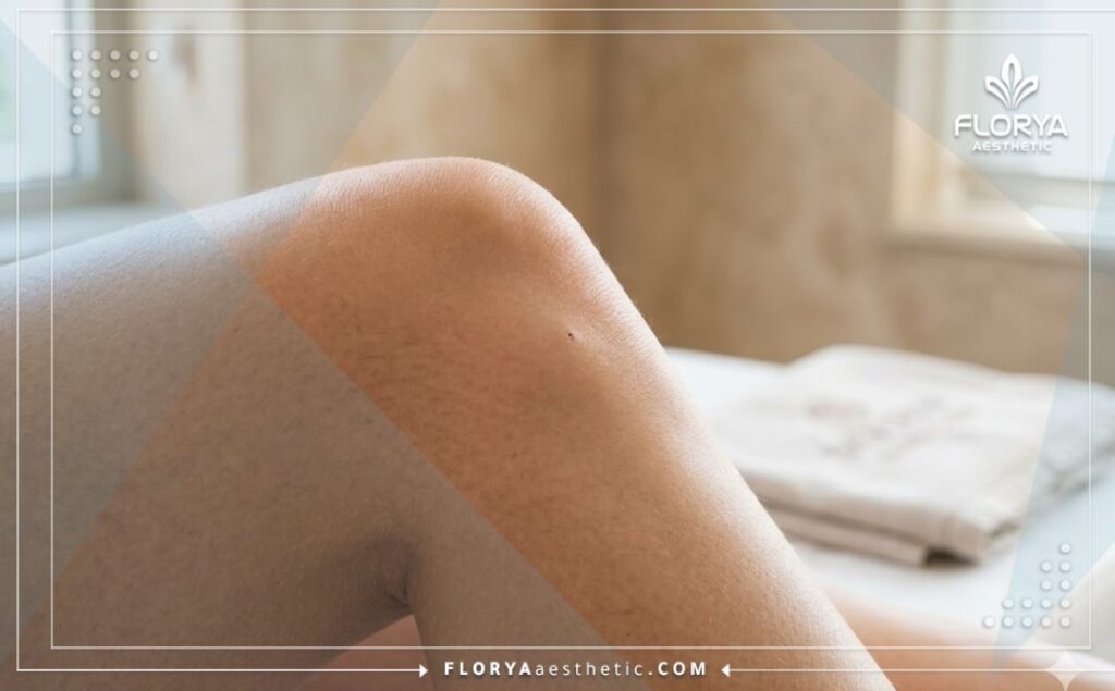 نتيجة مثالية وراحة تامة بعد الخضوع لعلاج العظام واستعادة مرونة الحركة.