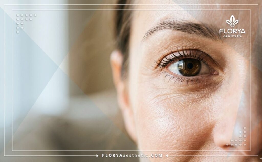 عين صحية ورؤية واضحة تعكس النتيجة المثالية بعد عملية الليزك