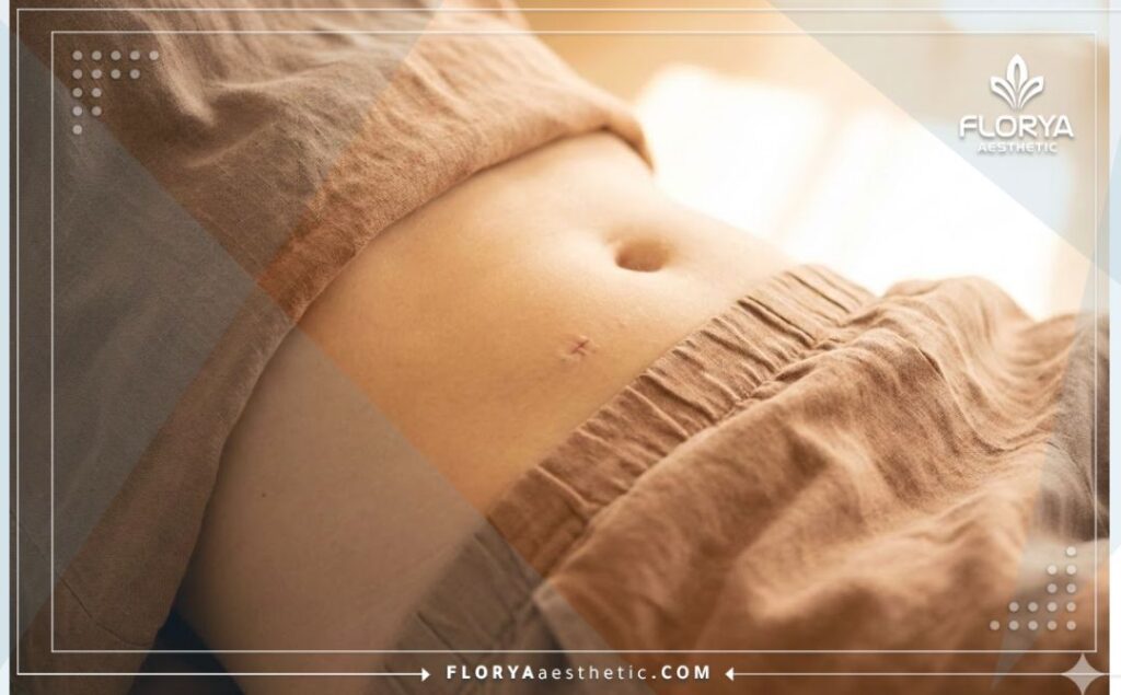 Digital 3D topographic scan of the urological surgical area for precision.