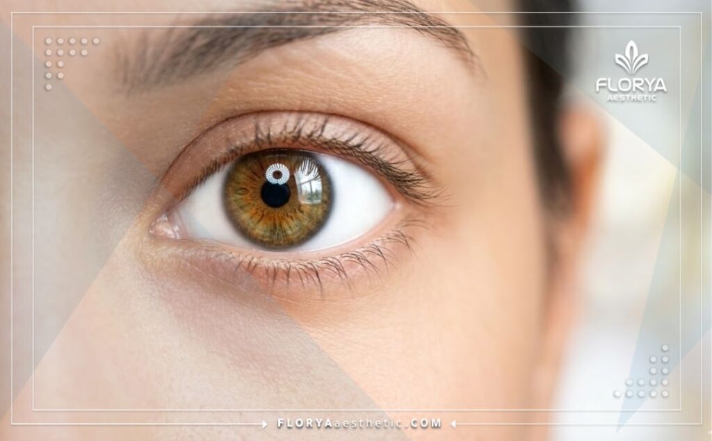 نتيجة مثالية ورؤية واضحة وجمال العين بعد عملية تصحيح النظر