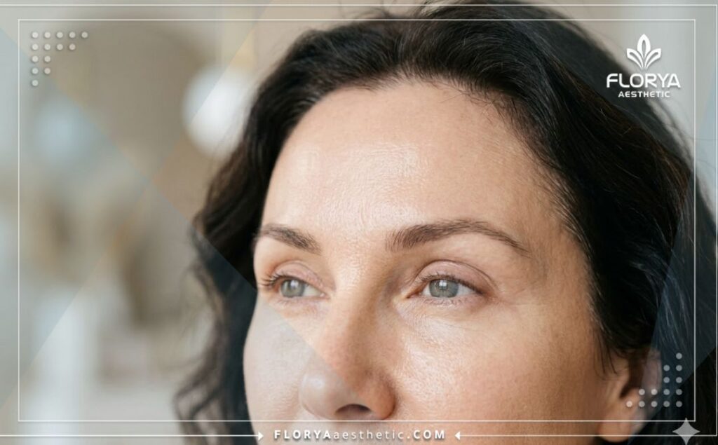 نتائج مثالية ومظهر طبيعي بعد عملية تجميل الجبهة