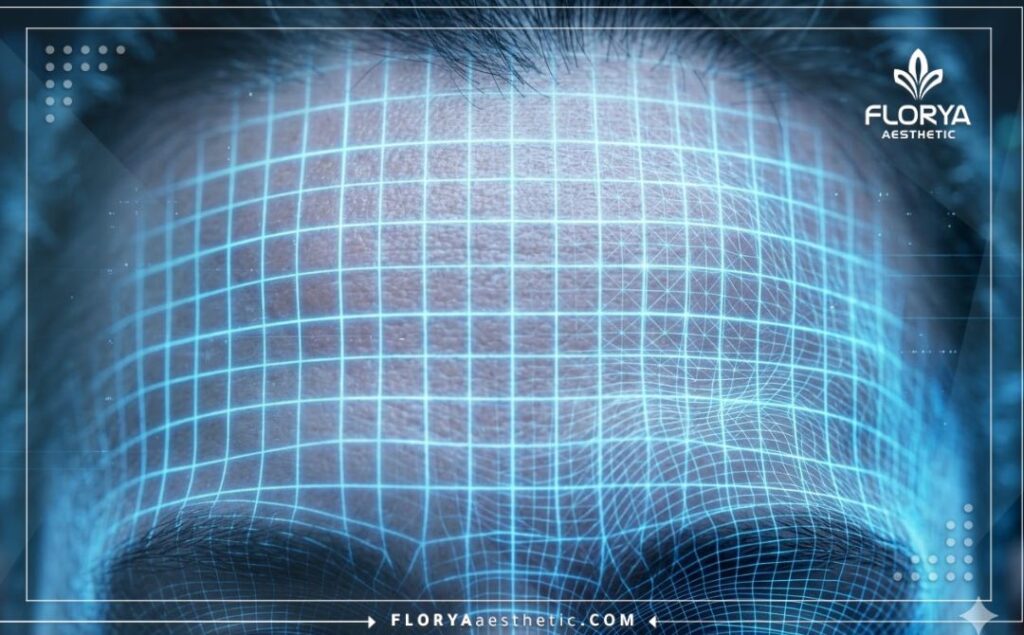 تصوير ثلاثي الأبعاد دقيق لمنطقة الجبهة يوضح التشريح الرقمي قبل إجراء الجراحة.