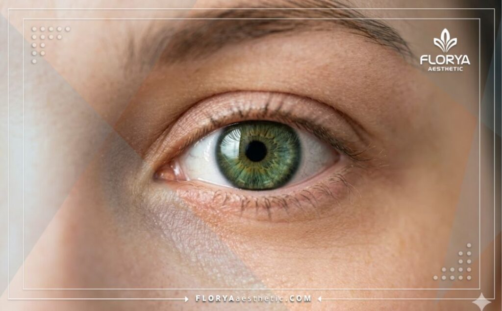 Gros plan d'un œil sain montrant le résultat parfait d'une chirurgie.