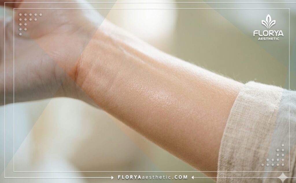 Cinematic close-up showing the flawless, healthy, and rejuvenated skin texture reflecting a perfect treatment result.