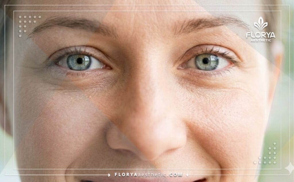 Close-up of clear, beautiful eyes showcasing the perfect result of laser vision correction.