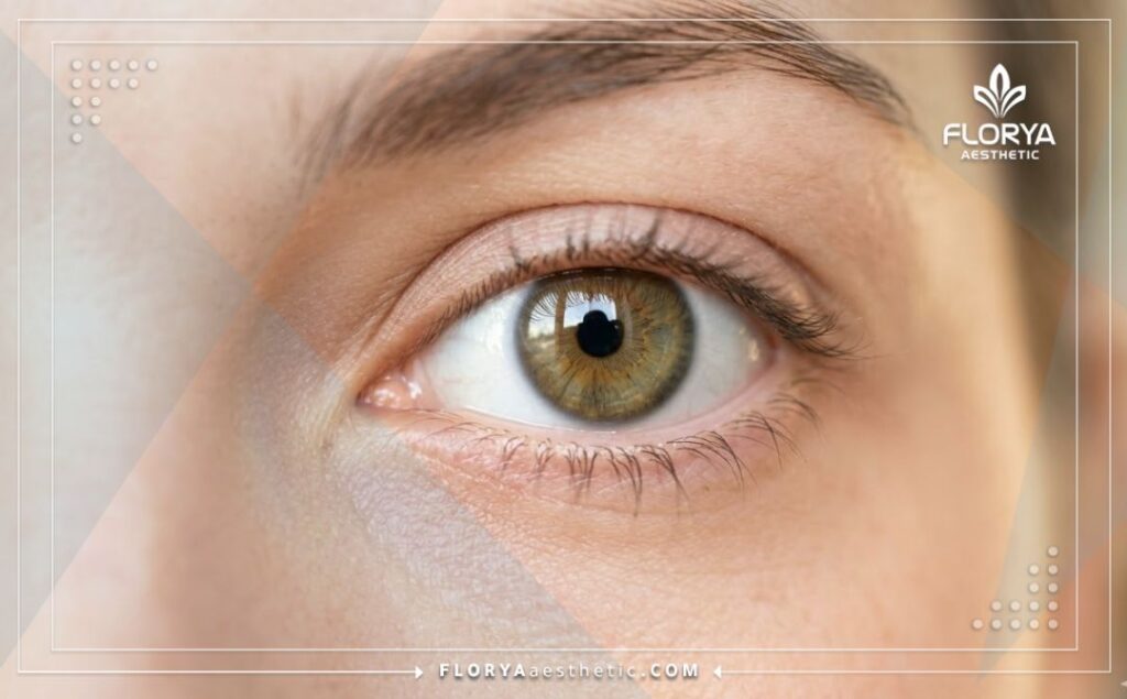 Идеальный результат после коррекции зрения, кристально чистый и здоровый глаз.