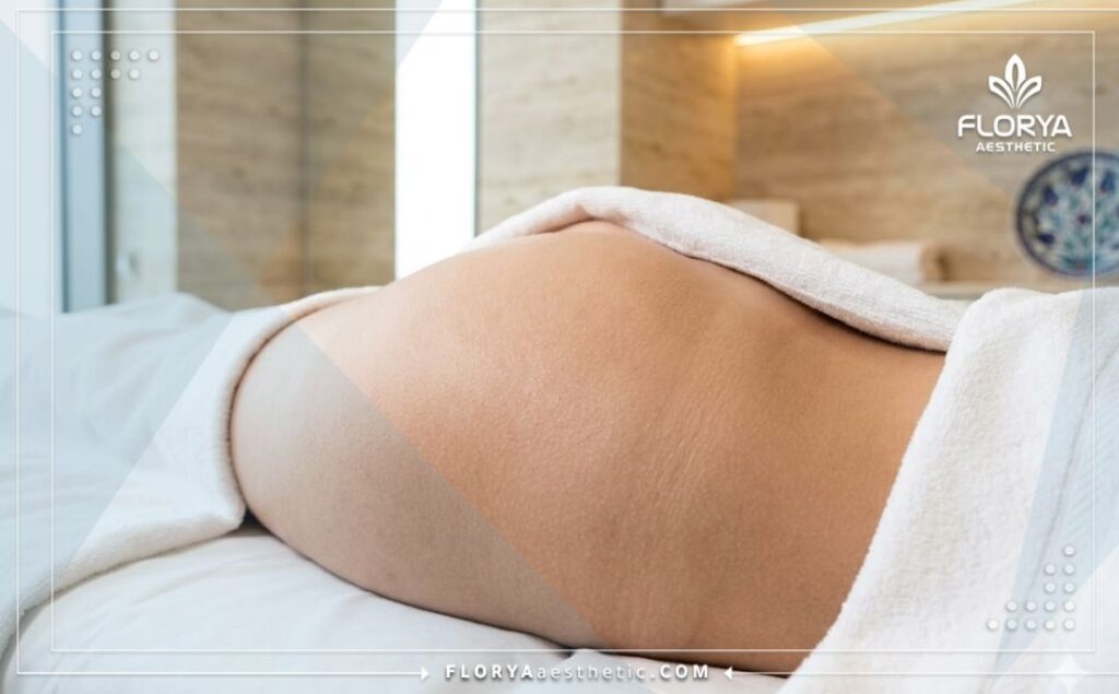 Resultado estético, natural y perfecto del procedimiento quirúrgico