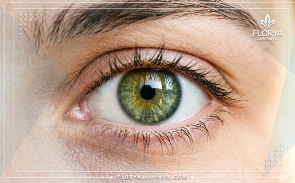 Идеальный результат коррекции зрения крупным планом с кристально чистой радужкой