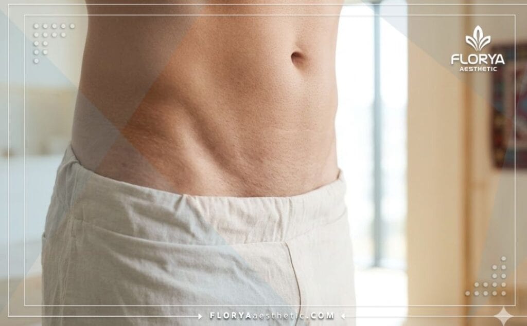 Résultat esthétique parfait et naturel pour les hommes