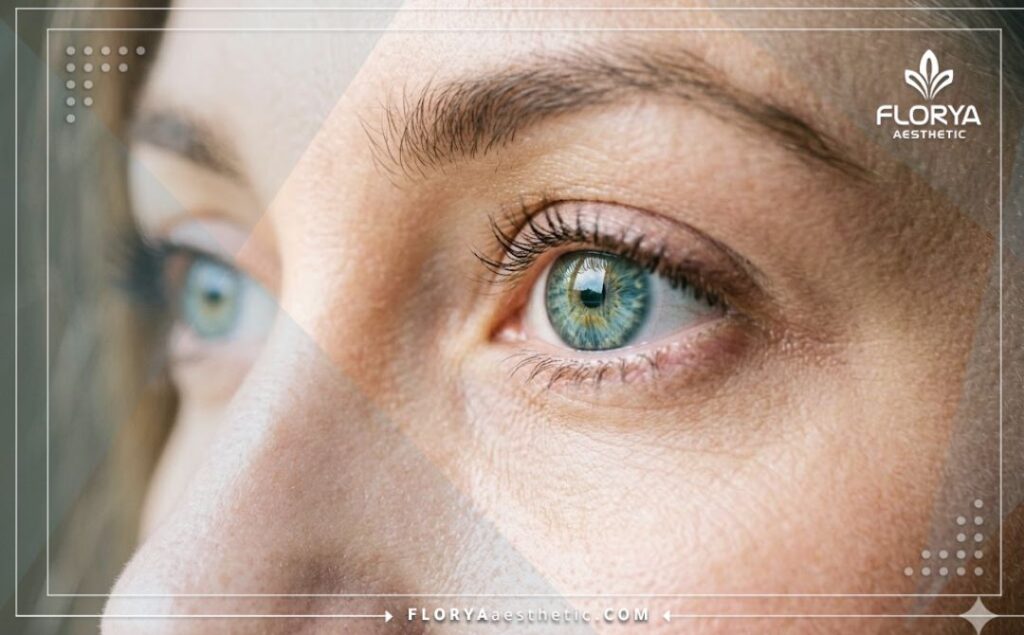 Макросъемка здорового глаза, демонстрирующая идеальный результат после коррекции зрения.