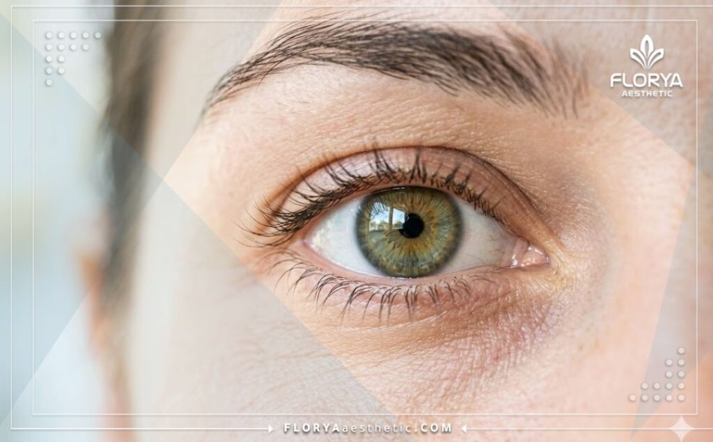 Ojo claro y perfecto tras un procedimiento oftalmológico exitoso