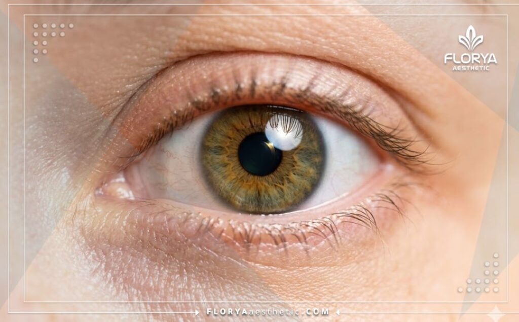 Здоровый глаз с идеальным ясным зрением после лечения