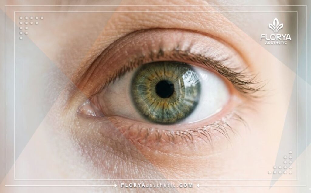 Yeux clairs et brillants après une opération réussie