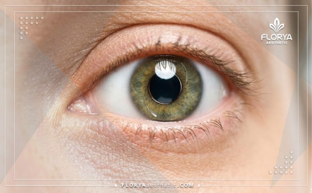 Toma de cerca que resalta el resultado perfecto y la visión clara después de la cirugía