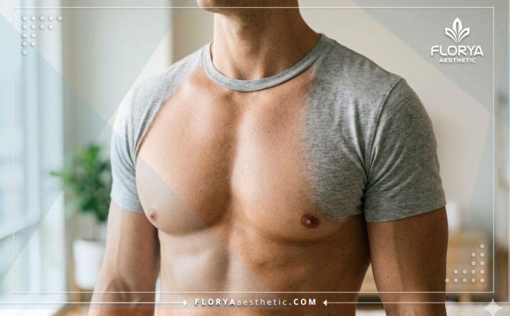 Resultado estético impecable, natural y exitoso del pecho