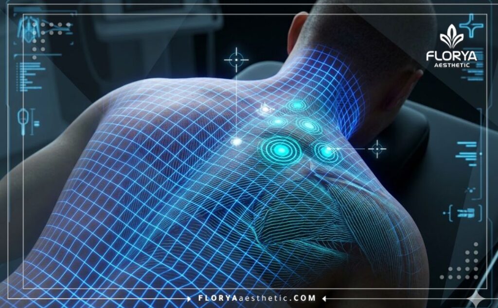 مسح ضوئي ثلاثي الأبعاد دقيق يوضح العضلات المستهدفة لعلاج الألم بدقة.