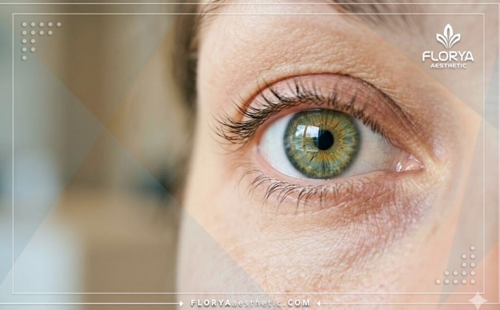 نتيجة مثالية وناجحة لعين صحية وواضحة بعد تلقي العلاج المتقدم.