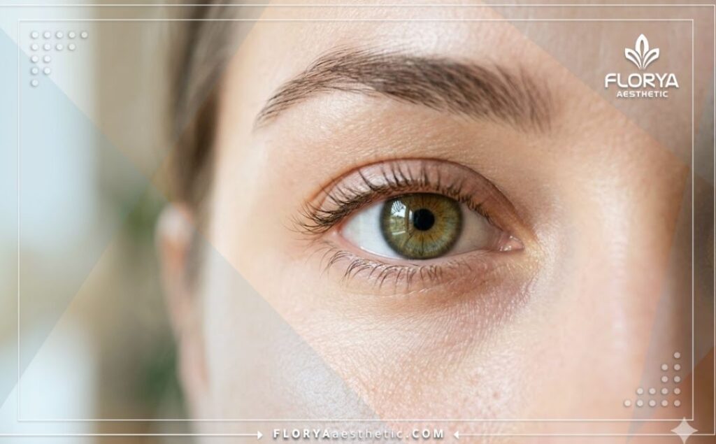 لقطة مقربة تبرز النتيجة المثالية لعملية تصحيح النظر وعين صحية تماماً