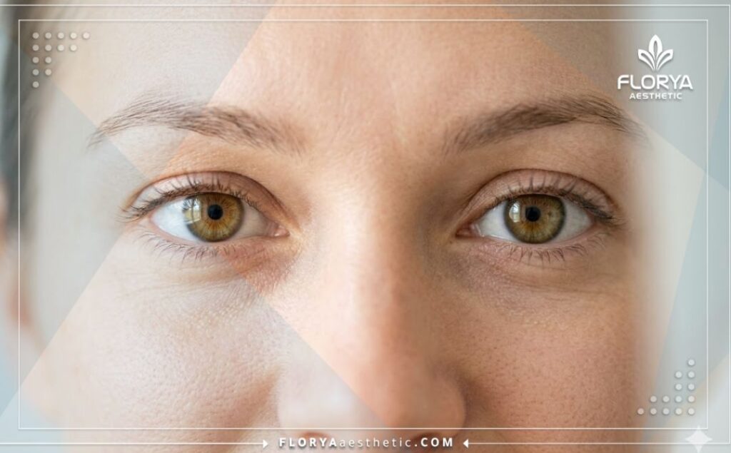 Крупный план красивых и здоровых глаз как идеальный результат коррекции зрения