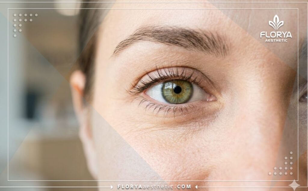 Идеальный результат операции на глазах с кристально чистым зрением